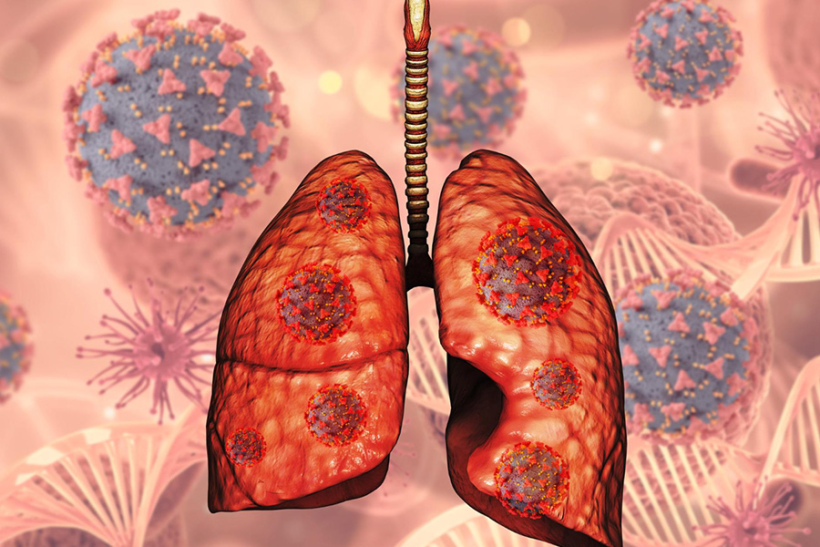 Combating silicosis in India: From compensation to prevention